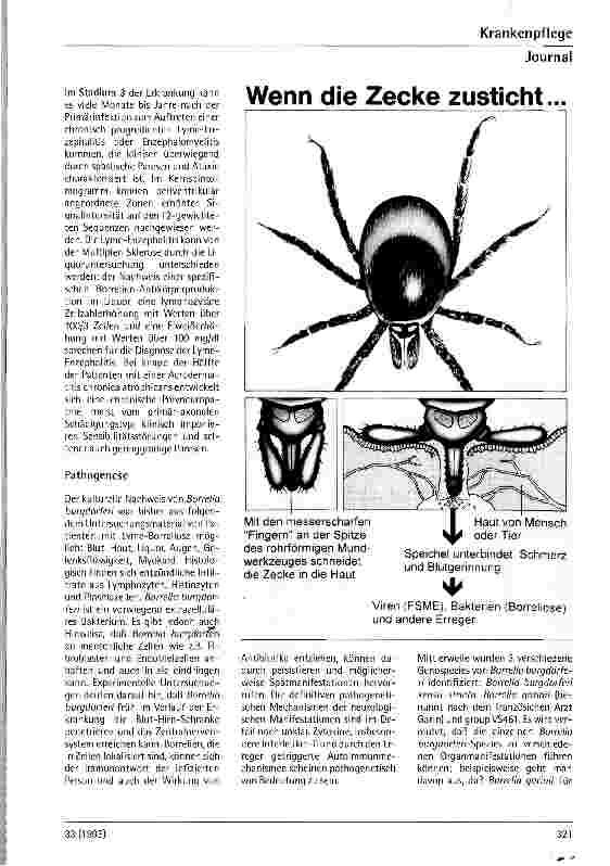 Vorschauseite 2: Lyme-Borreliose - Diagnostik und Therapie aus neurologischer Sicht
