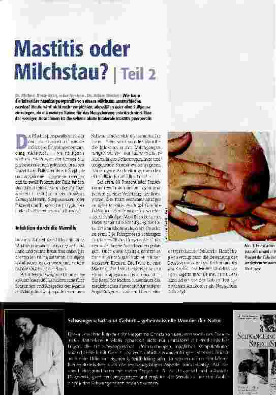 Vorschauseite 1: Mastitis oder Milchstau Teil 2
