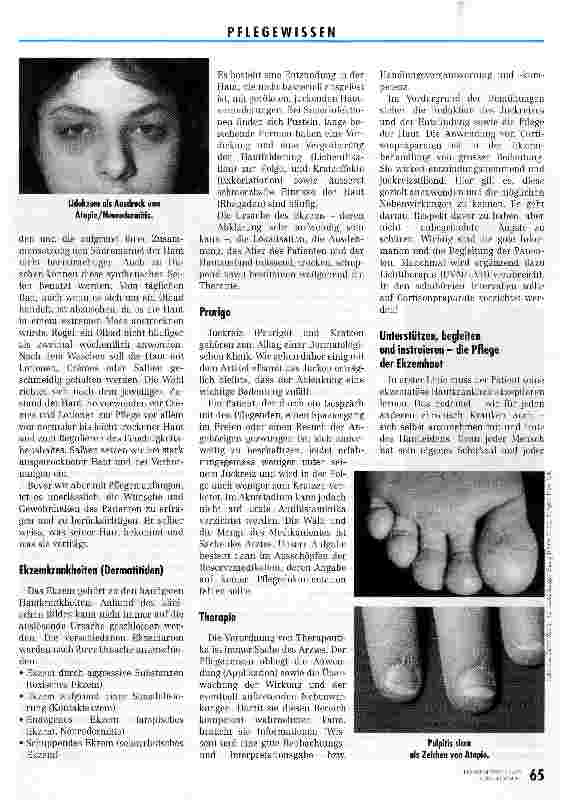 Vorschauseite 2: Ekzembehandlung - die Berner Version Replik auf Damit das Jucken erträglich bleibt in Heft 10/95