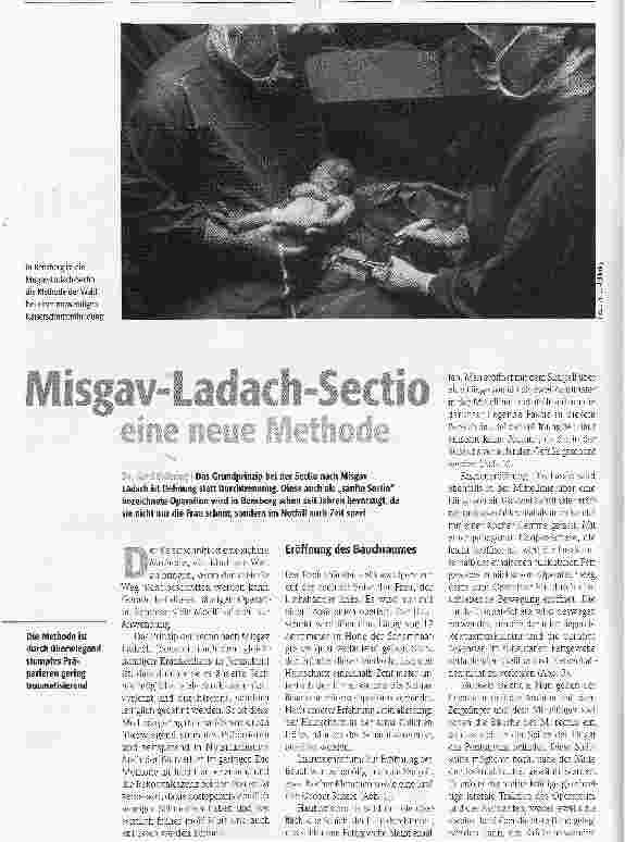 Vorschauseite 1: Misgav-Ladach-Sectioeine neue Methode