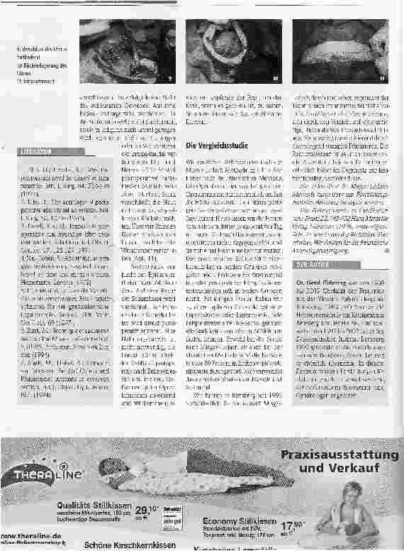 Vorschauseite 3: Misgav-Ladach-Sectioeine neue Methode