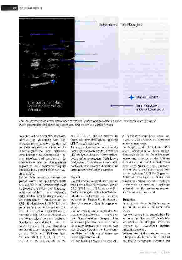 Vorschauseite 6: Kann der lymphologische Kompressionsverband in der Phase II der KPE die lymphostatische Fibrosklerose reduzieren?