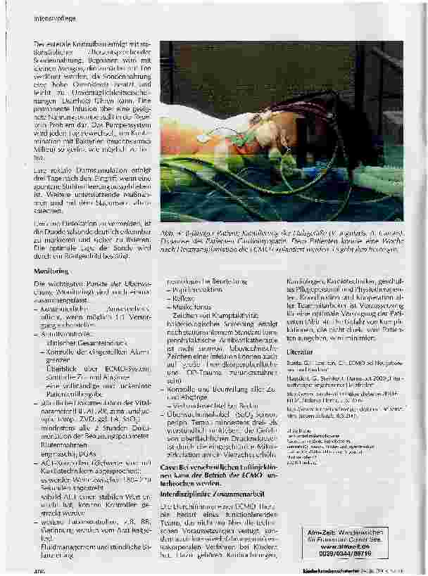 Vorschauseite 4: Pflege bei ECMO