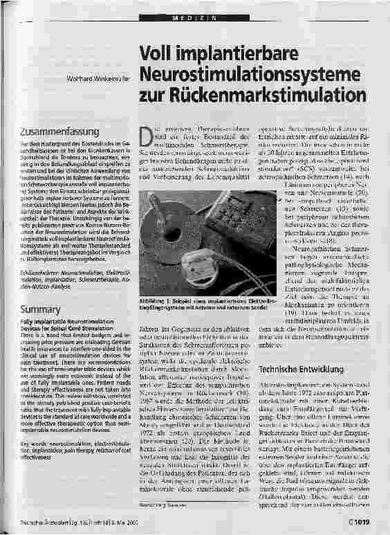 Vorschauseite 1: Voll implantierbare Neurostimulationssysteme zur Rückenmarkstimulation