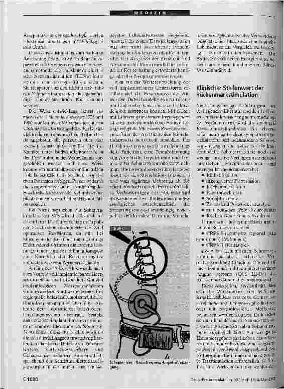 Vorschauseite 2: Voll implantierbare Neurostimulationssysteme zur Rückenmarkstimulation