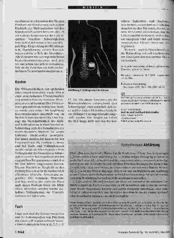 Vorschauseite 4: Voll implantierbare Neurostimulationssysteme zur Rückenmarkstimulation