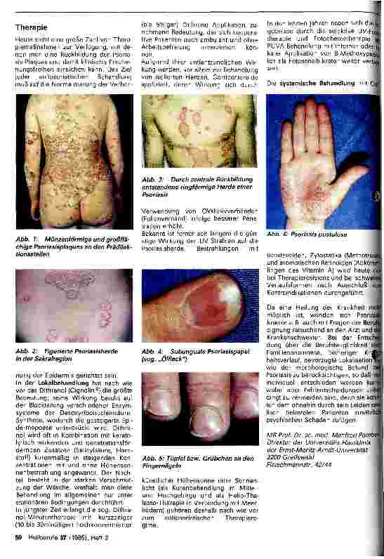 Vorschauseite 2: Psoriasis vulgaris
