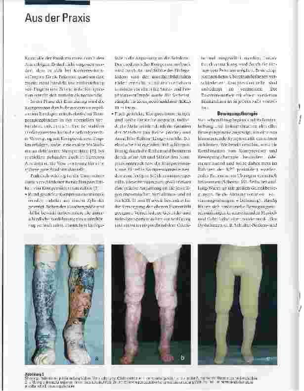 Vorschauseite 3: Komplexe physikalische Entstauungstherapie (KPE) beim Lymphödem