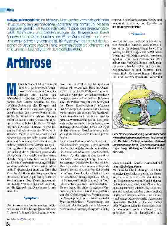 Vorschauseite 1: Arthrose Problem bei Multimorbidität