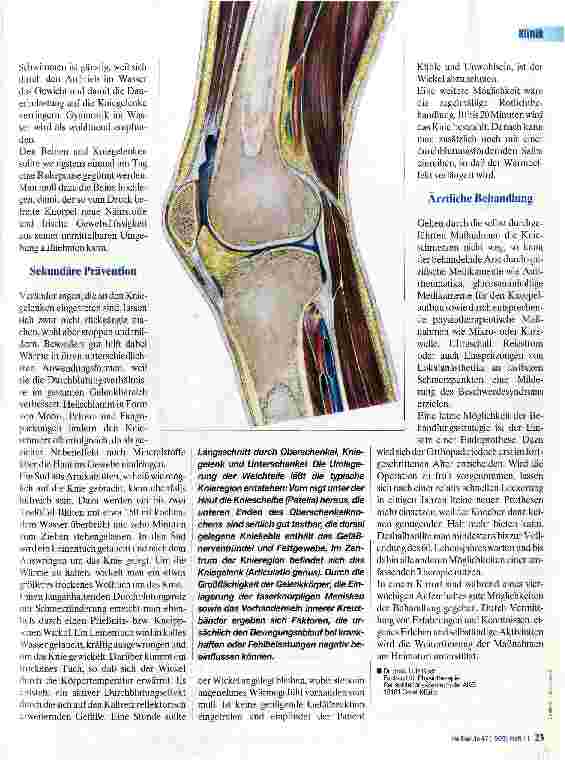 Vorschauseite 2: Arthrose Problem bei Multimorbidität