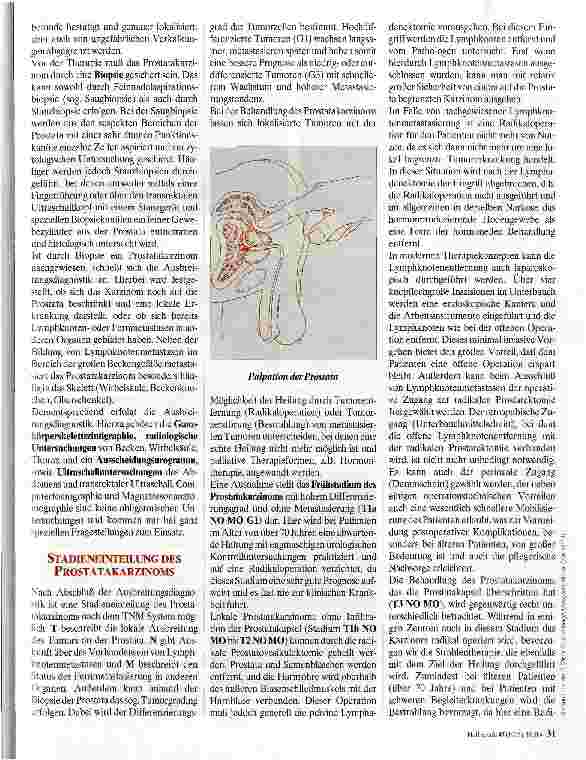Vorschauseite 2: Behandlung des Prostatakarzinoms Erkrankungshäufung im Alter