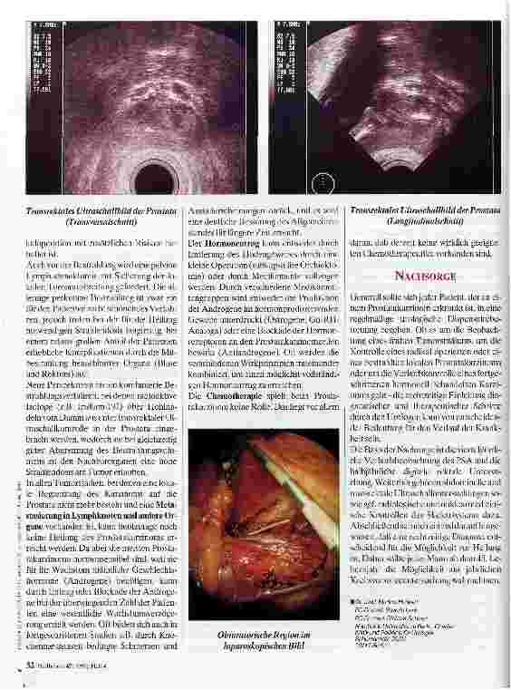 Vorschauseite 3: Behandlung des Prostatakarzinoms Erkrankungshäufung im Alter
