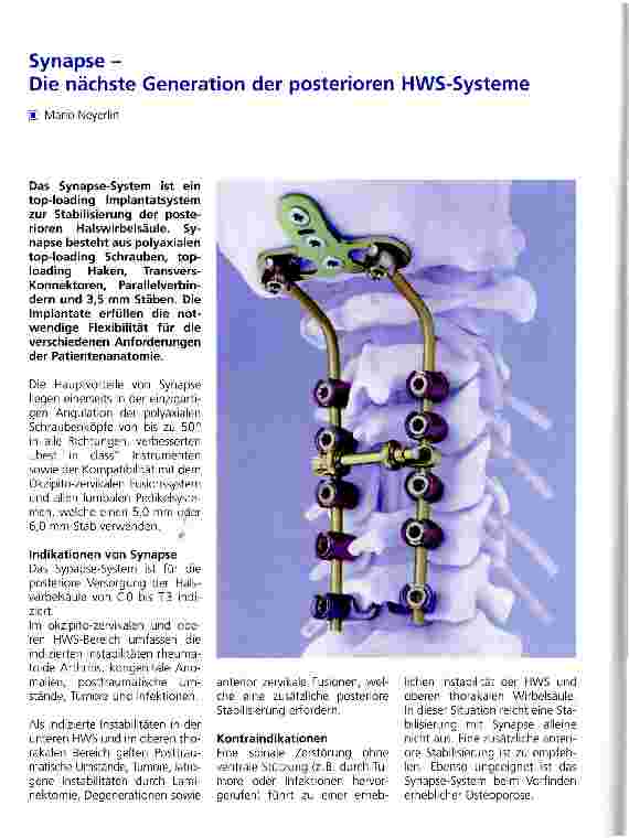 Vorschauseite 1: Synapse -Die nächste Generation der posterioren HWS-Systeme