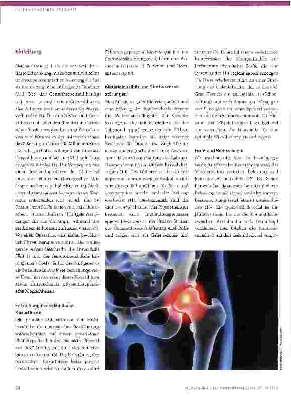 Vorschauseite 2: Risikofaktoren für Koxarthrose und ihre physiotherapeutische Behandlung Teil 1 - Instabilität des Hüftgelenks