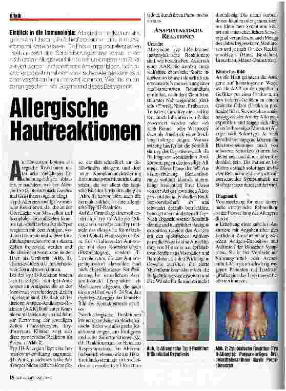 Vorschauseite 1: Allergische Hautreaktionen Einblick in die Immunologie