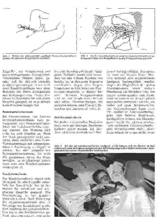 Vorschauseite 3: Postoperative Schmerztherapie bei Kindern
