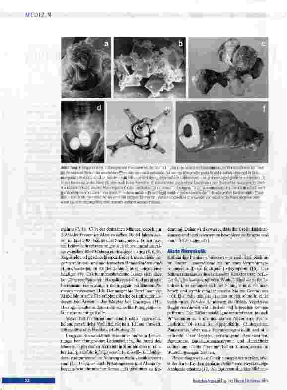 Vorschauseite 2: Urolithiasis - interdisziplinäre Herausforderung in Diagnostik, Therapie und Metaphylaxe