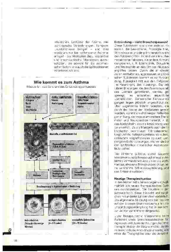 Vorschauseite 2: Asthma - das bronchiale Chaos