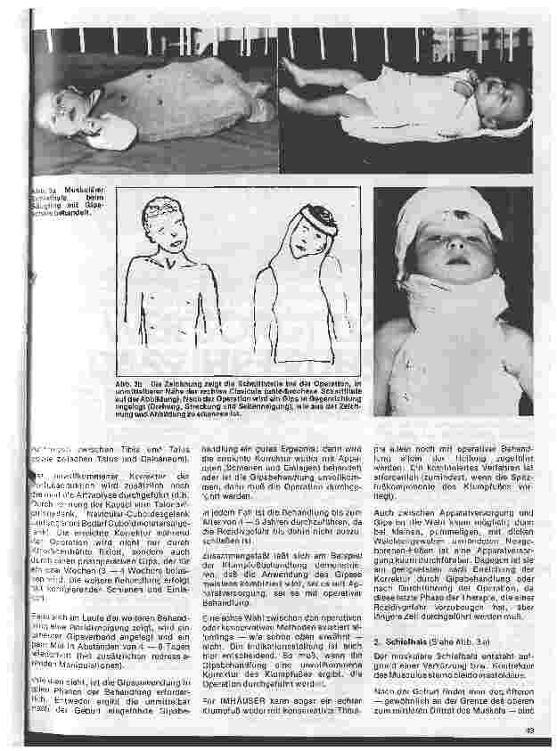 Vorschauseite 4: Moderne Entwicklung in der Orthopädie 1. Teil: Gipsanwendung in der Orthopädie