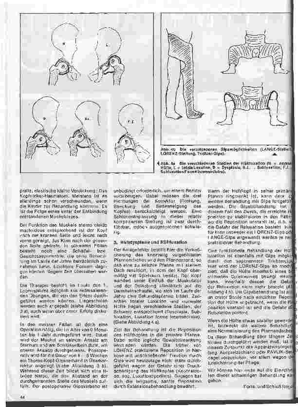Vorschauseite 5: Moderne Entwicklung in der Orthopädie 1. Teil: Gipsanwendung in der Orthopädie