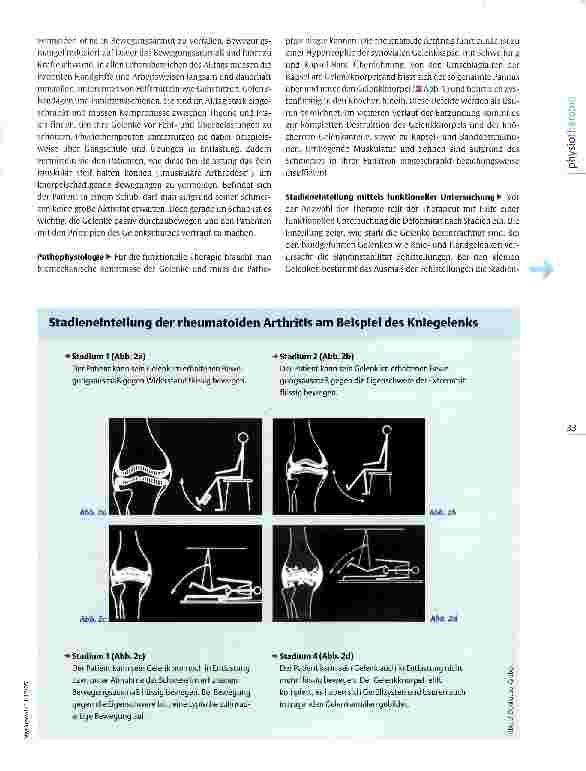 Vorschauseite 2: Physiotherapie bei rheumatoider Arthritis Viel bewegen, wenig belasten
