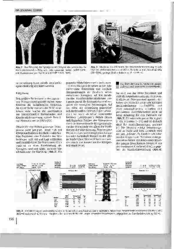 Vorschauseite 3: Osteoporose - Diagnostik und Therapie
