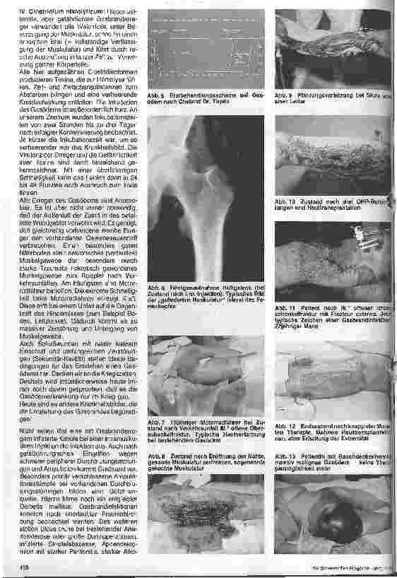 Vorschauseite 2: Die hyperbare Medizin - Möglichkeiten und Grenzen der Sauerstoff-Überdrucktherapie (4. Folge)