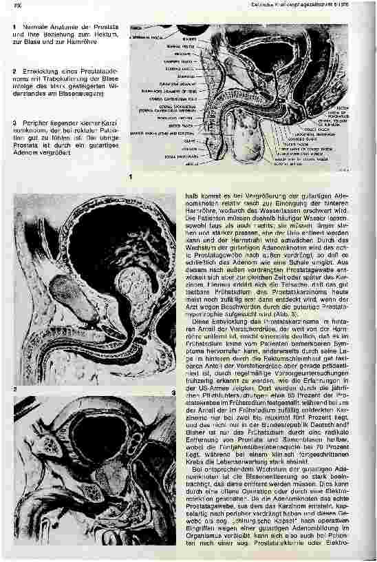 Vorschauseite 2: Vorsorgeuntersuchung in der Urologie