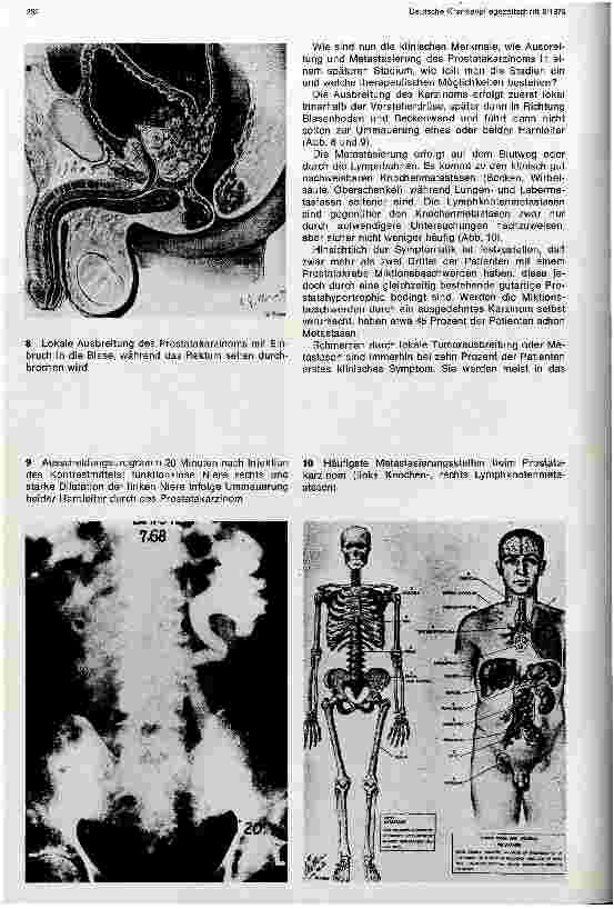 Vorschauseite 4: Vorsorgeuntersuchung in der Urologie
