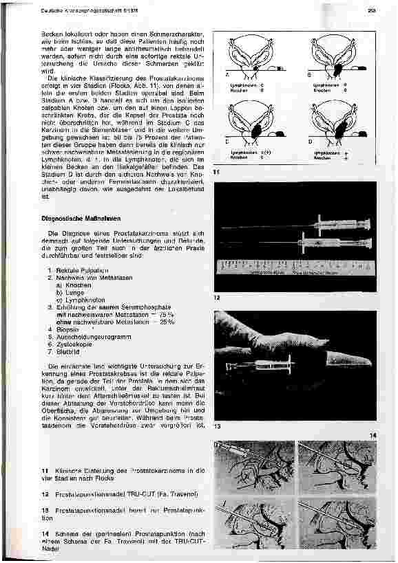 Vorschauseite 5: Vorsorgeuntersuchung in der Urologie
