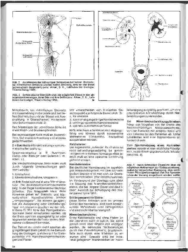 Vorschauseite 3: Urologie 6. Folge: Harnsteinleiden