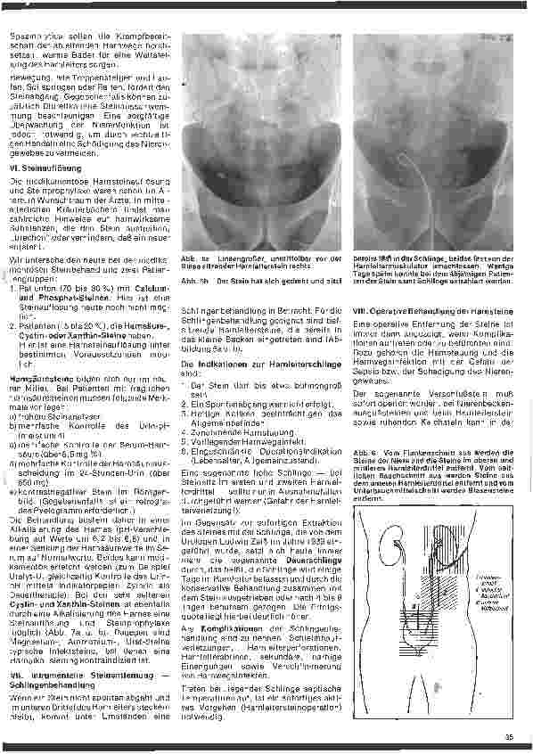 Vorschauseite 4: Urologie 6. Folge: Harnsteinleiden