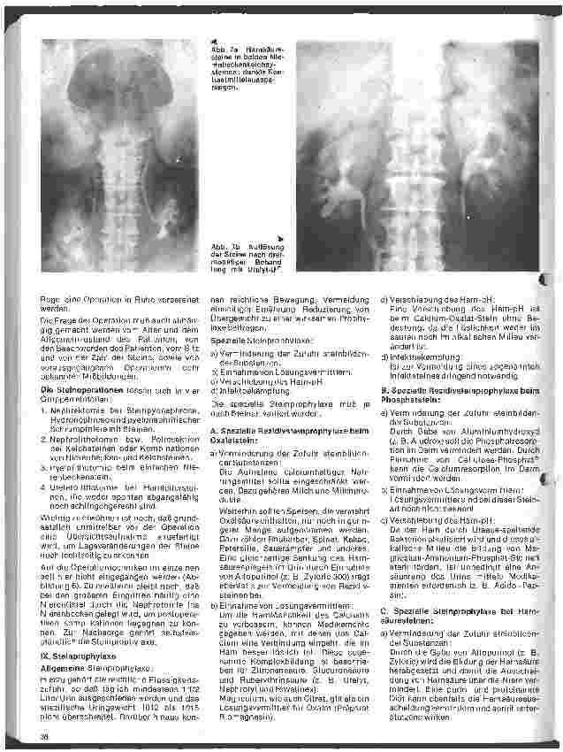 Vorschauseite 5: Urologie 6. Folge: Harnsteinleiden