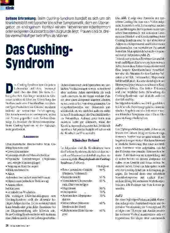 Vorschauseite 1: Das Cushing-Syndrom