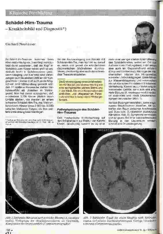 Vorschauseite 1: Schädel-Hirn-Trauma Krankheitsbild und Diagnostik