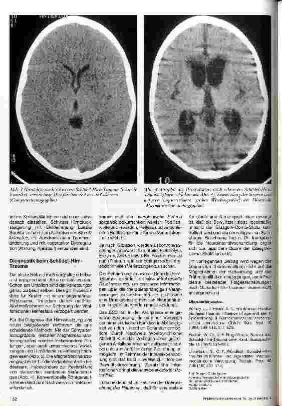 Vorschauseite 3: Schädel-Hirn-Trauma Krankheitsbild und Diagnostik
