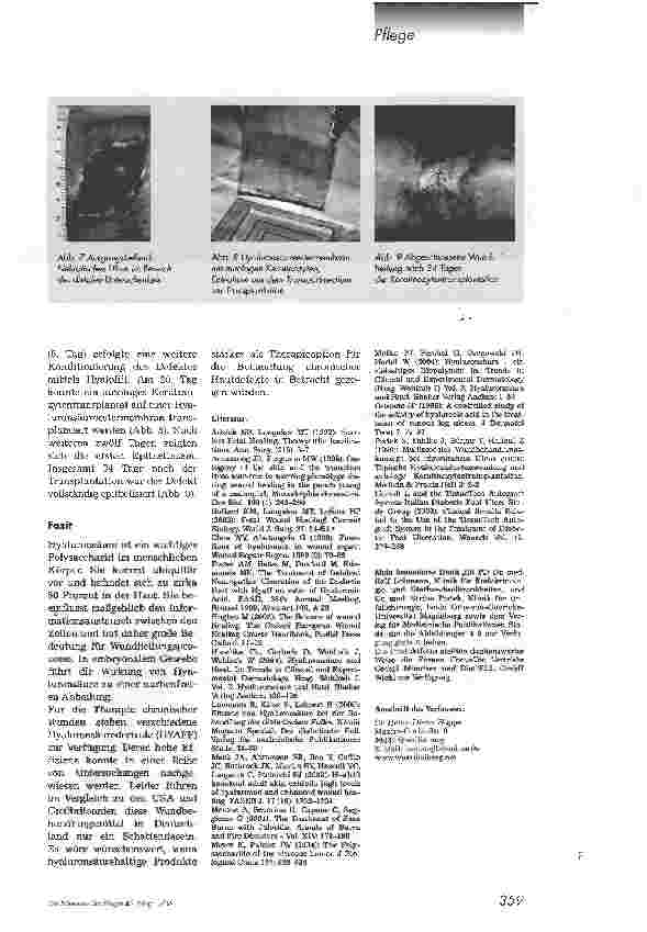 Vorschauseite 5: Wund(er)mittel HyaluronsäureHyaluronsäurederivate zeigen sehr positive Effekte bei der Behandlung chronischer Wunden