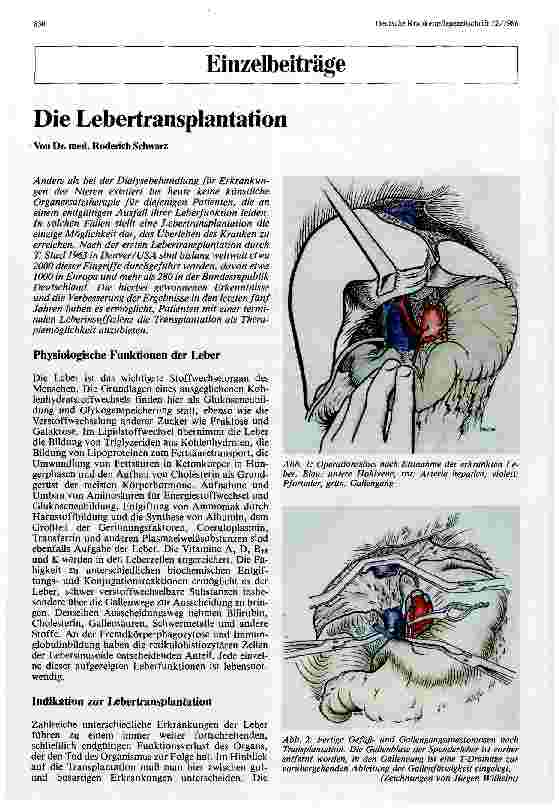 Vorschauseite 1: Die Lebertransplantation
