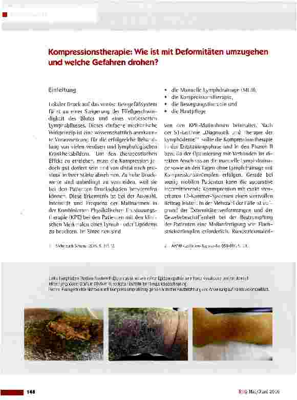 Vorschauseite 1: Kompressionstherapie: Wie ist mit Deformitäten umzugehen und welche Gefahren drohen?