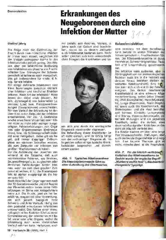 Vorschauseite 1: Erkrankungen des Neugeborenen durch eine Infektion der Mutter