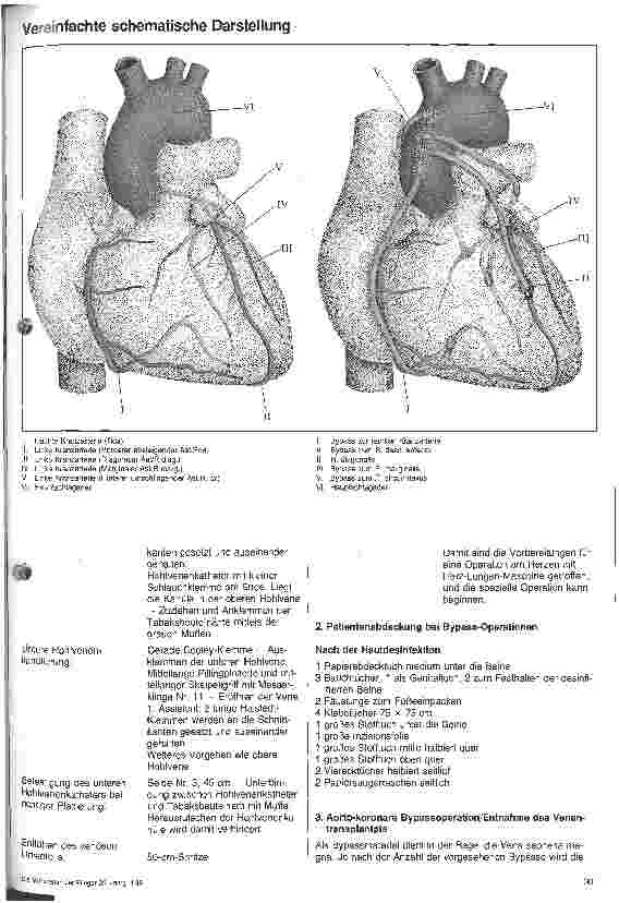 Vorschauseite 2: Informationsmapppe Herzchirurgie 2. Teil: Die Einarbeitung des Op.-Personals