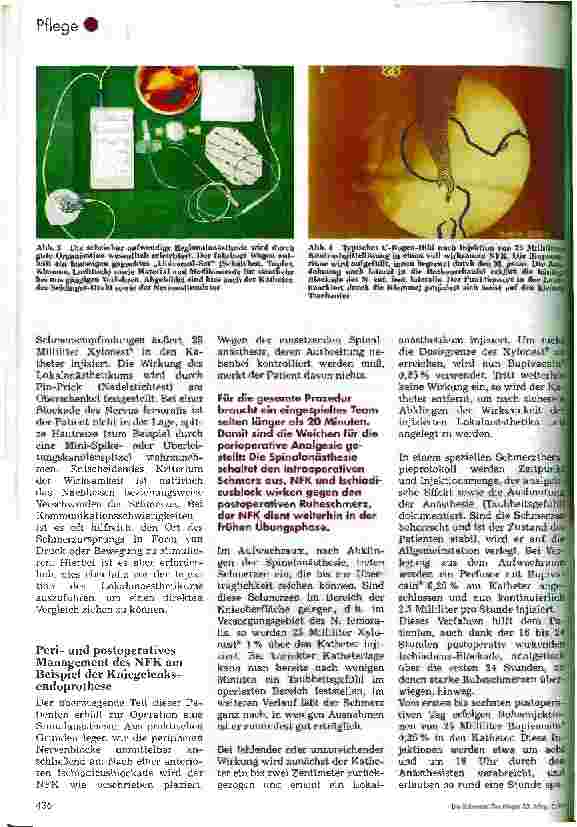 Vorschauseite 4: Der Nervus-Femoralis-Katheter Ein etabliertes Verfahren? Teil 1