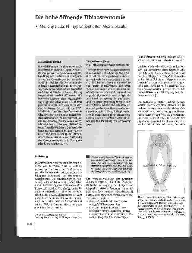 Vorschauseite 1: Die hohe öffnende Tibiaosteotomie