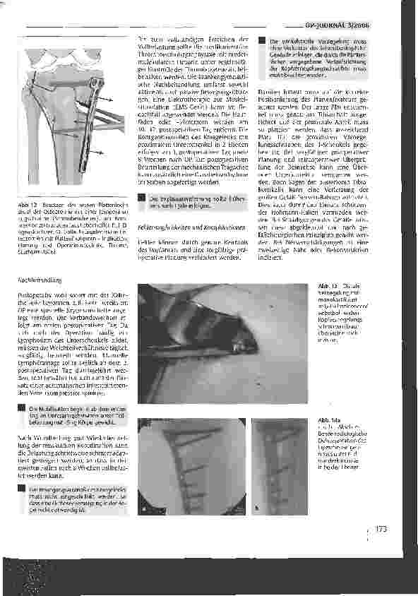 Vorschauseite 6: Die hohe öffnende Tibiaosteotomie
