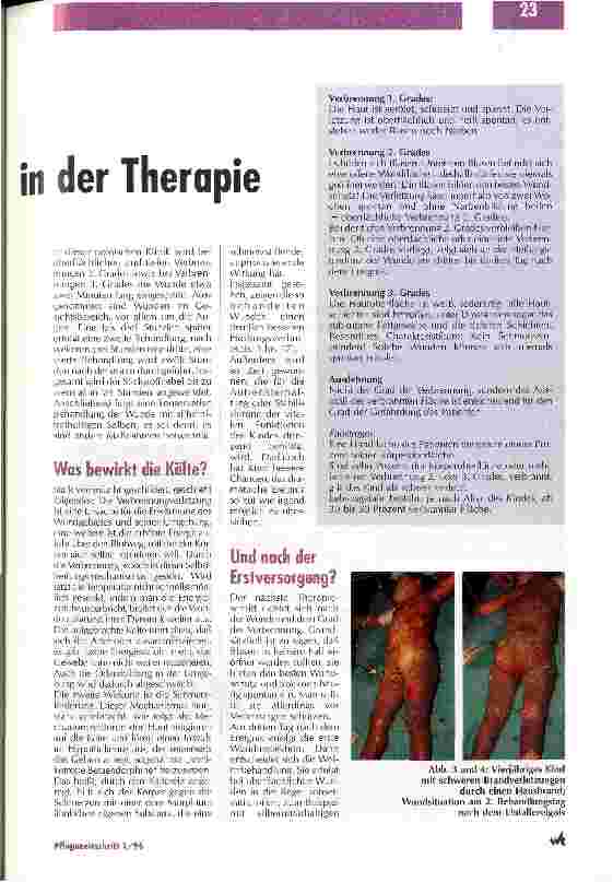 Vorschauseite 2: Eine polnische Spezialklinik geht neue Wege in der Therapie Verbrennungen und Verbrühungen im Kindesalter