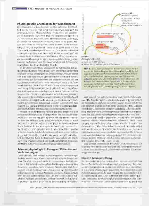 Vorschauseite 2: Physiologische Grundlagen manueller Mobilisation von Narben und Bindegewebe sowie Dosierung bei Patienten mit großflächigen Brandverletzungen