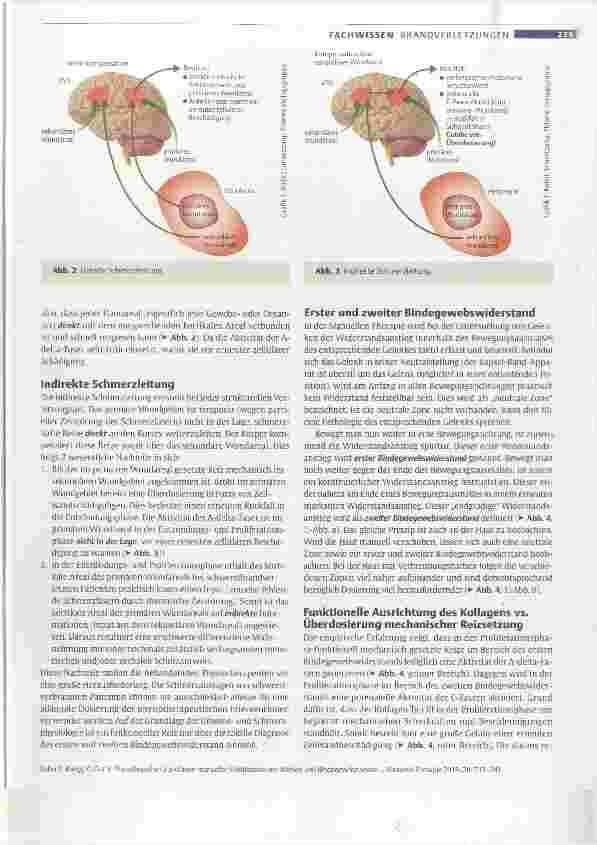 Vorschauseite 3: Physiologische Grundlagen manueller Mobilisation von Narben und Bindegewebe sowie Dosierung bei Patienten mit großflächigen Brandverletzungen