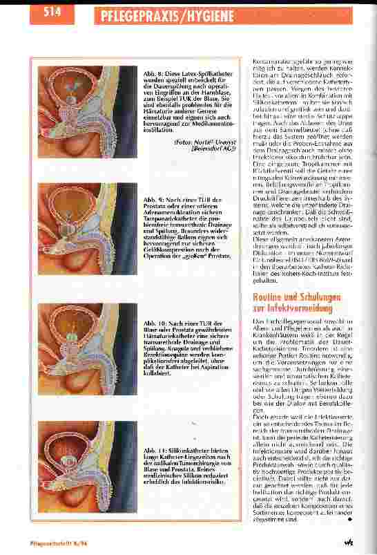 Vorschauseite 3: Harnwegsinfektionen sind vermeidbar Hygiene im transurethralen Katheterismus
