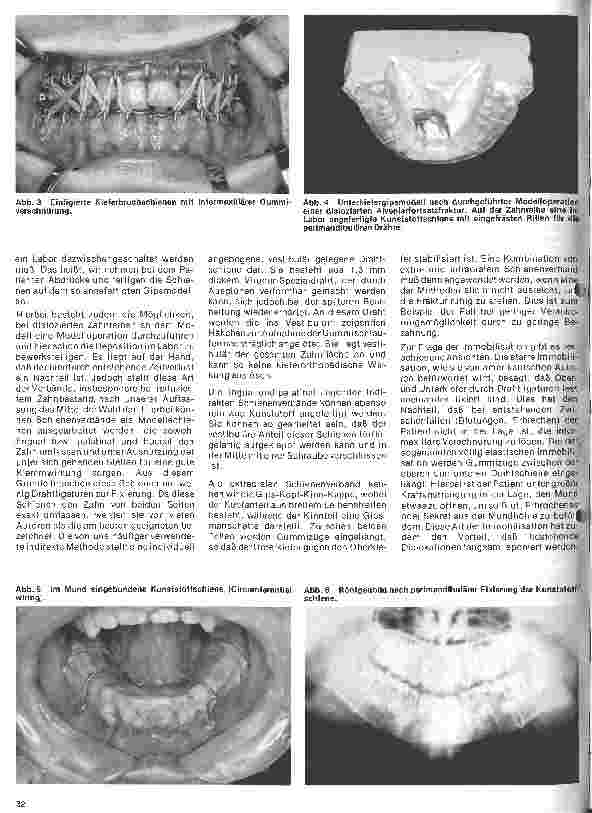 Vorschauseite 2: Zahn-Mundund Kieferchirurgie 9. Folge: Traumatologie II Therapie der Kieferbrüche