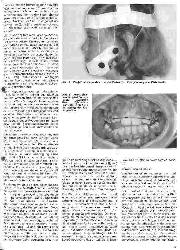 Vorschauseite 3: Zahn-Mundund Kieferchirurgie 9. Folge: Traumatologie II Therapie der Kieferbrüche
